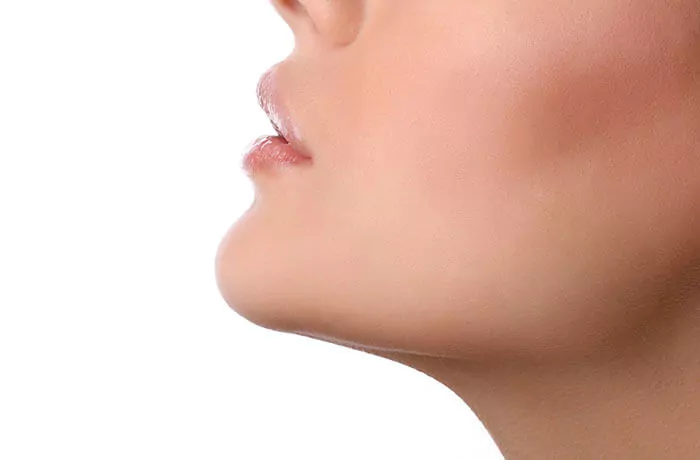 kybella jowls cheeks