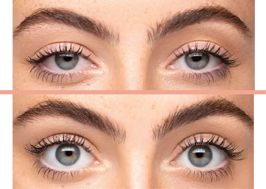 upneeq eye lift