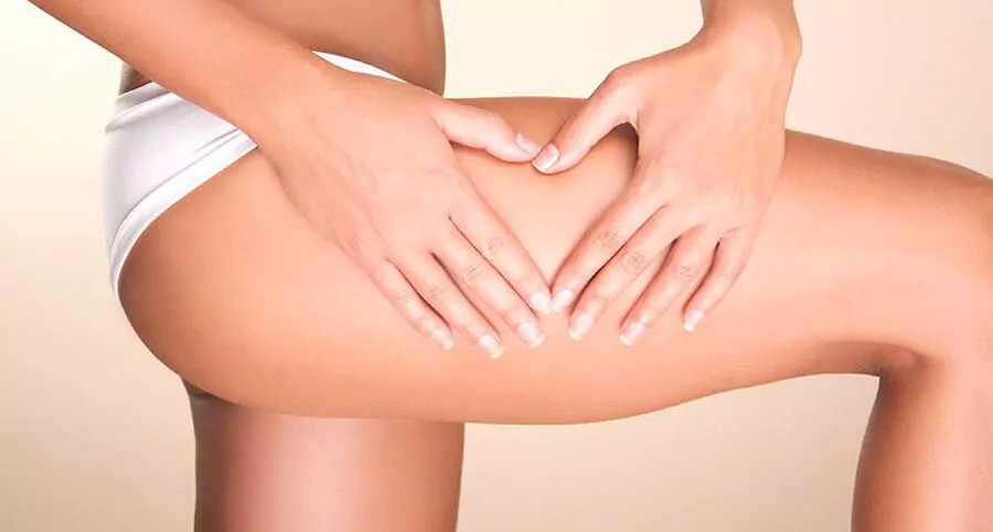 cellulite treatment